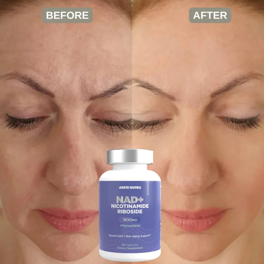 Arete NAD+ Nicotinamide Riboside
