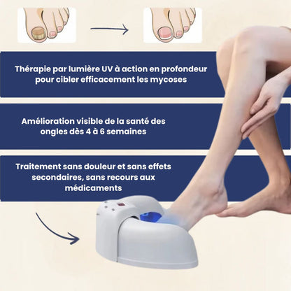 Soin Antifongique des Ongles – Action Ciblée par Lumière UV