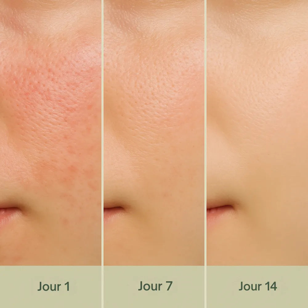 NIDA-Sérum Apaisant aux Spicules Pore
