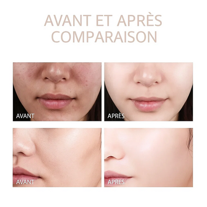 Kit Premium Peau de verre (6 pièces)