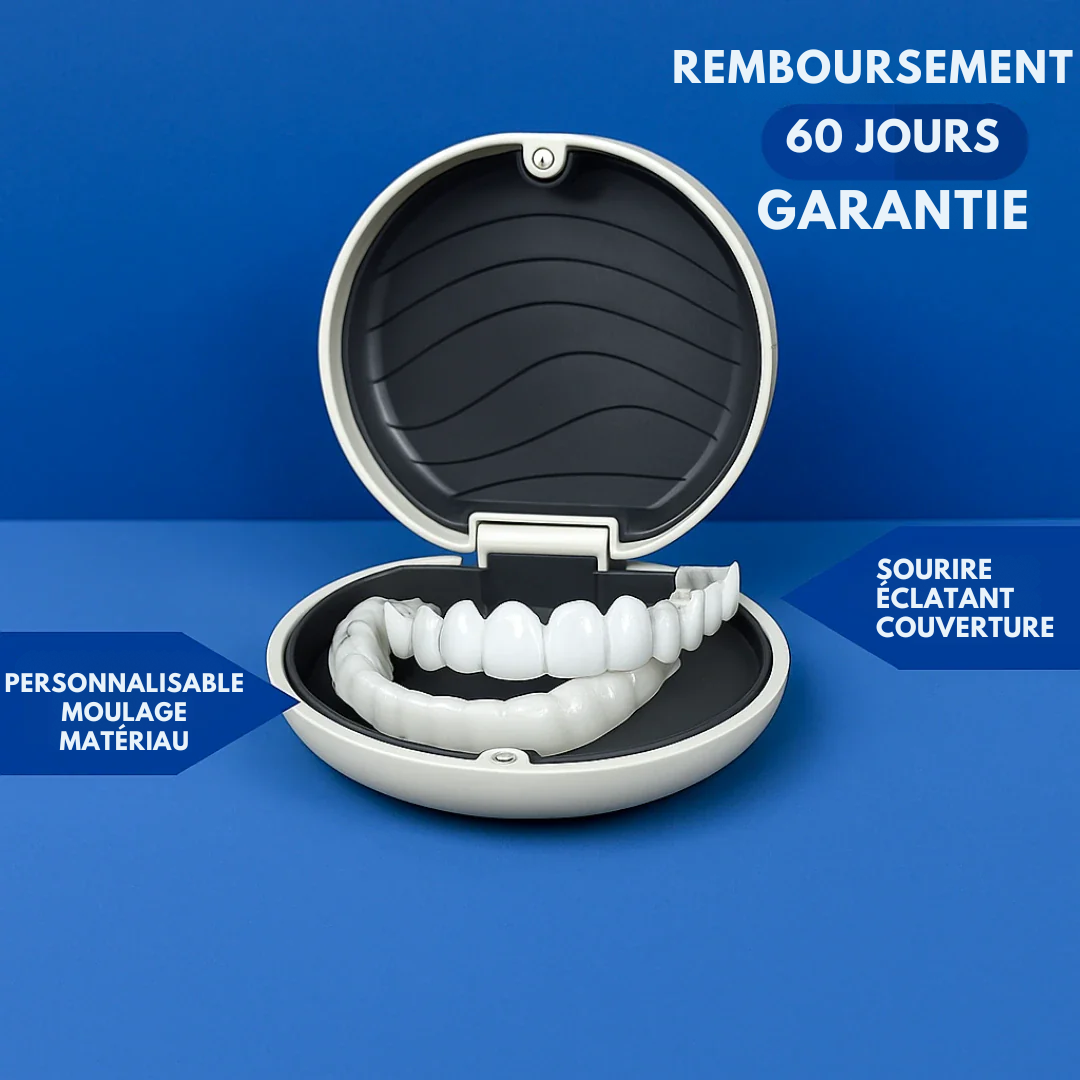 Facettes à clipser